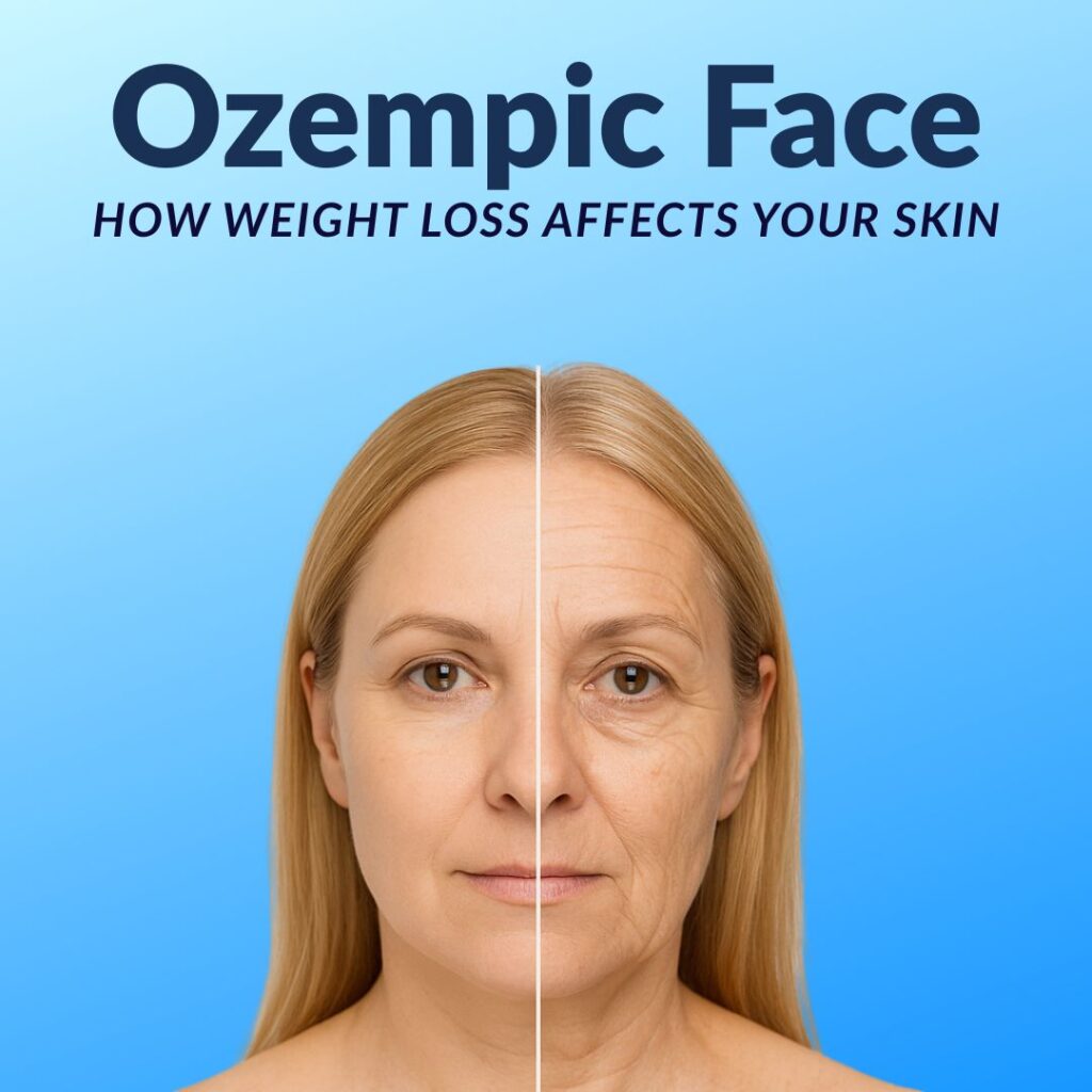 ozempic-face-before-after-weight-loss.
